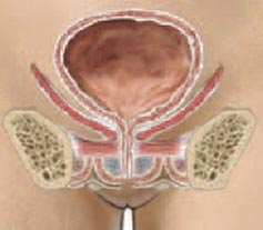 Female dilatation